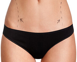Body Plastic Surgery Before and After Photos